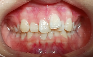 case13-a.jpg