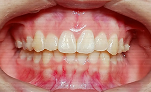 case13-b-1.jpg