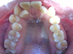 case14-before3-1-e1747028603531.jpg